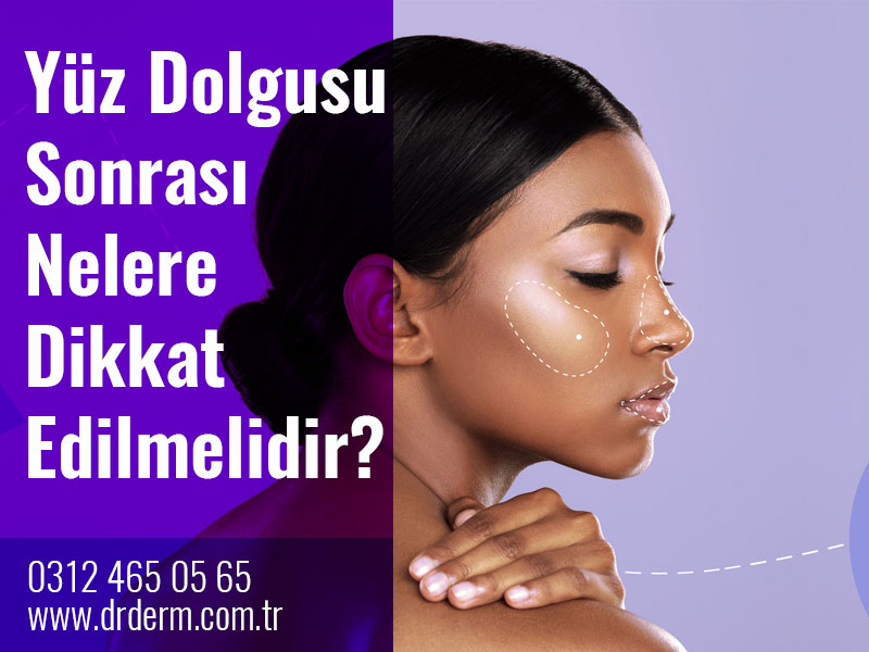 Yüz Dolgusu Sonrası Nelere Dikkat Edilmelidir?