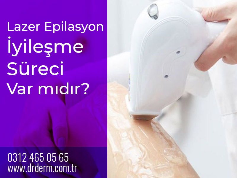 Lazer Epilasyon İyileşme Süreci Var mıdır?