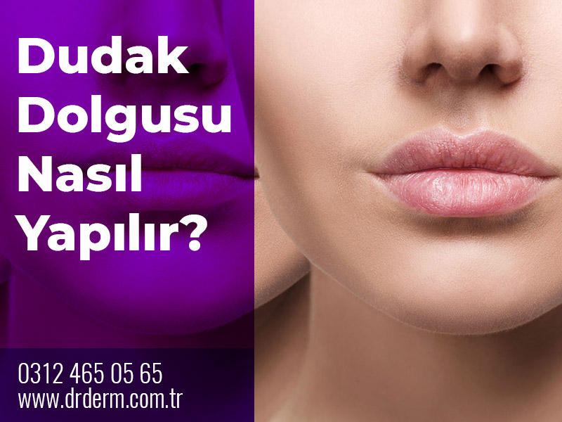 Dudak Dolgusu Nasıl Yapılır?