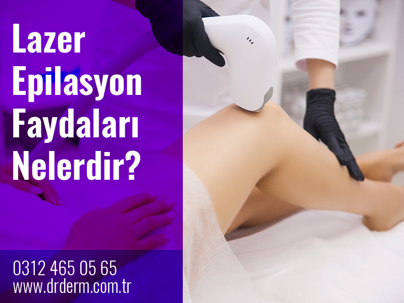 Lazer Epilasyon Faydaları Nelerdir?