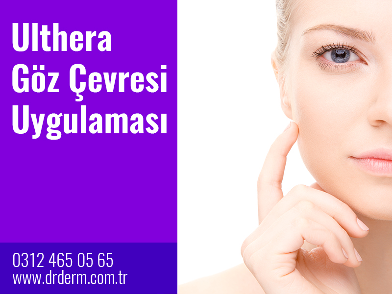 Ulthera Göz Çevresi Uygulaması
