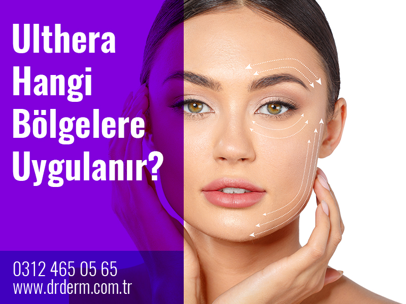 Ultherapy Nerelere Yaptırılır