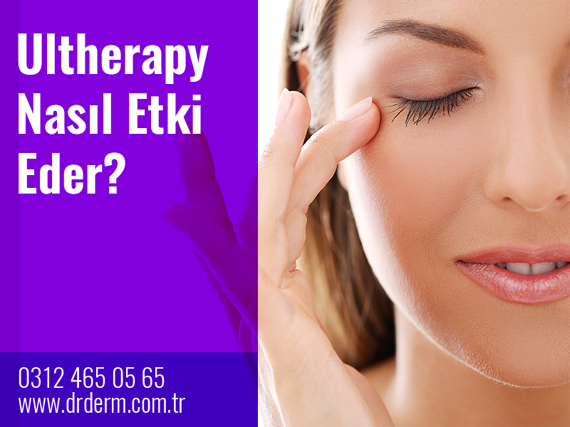 Ultherapy Nasıl Etki Eder?