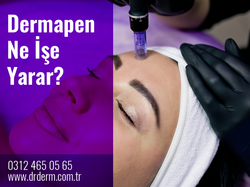Dermapen Ne İşe Yarar?