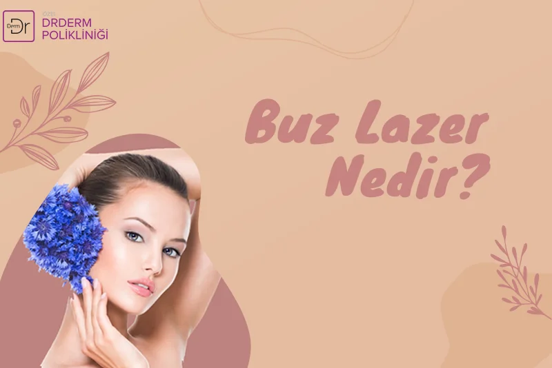 Buz Lazer Nedir?