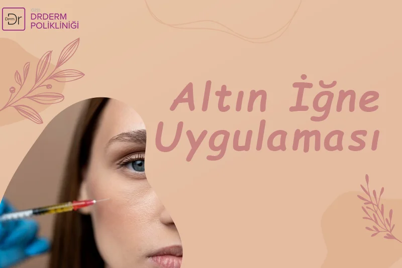 Altın İğne Uygulaması