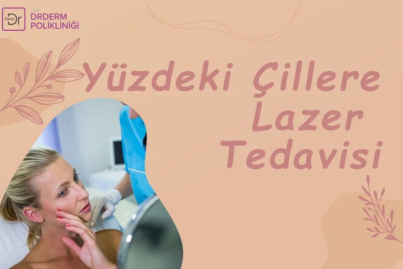 Yüzdeki Çillere Lazer Tedavisi
