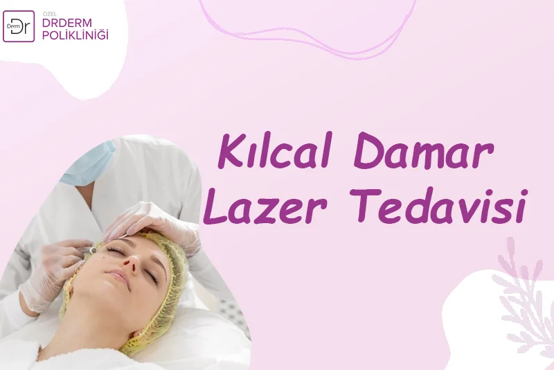 Kılcal Damar Lazer Tedavisi